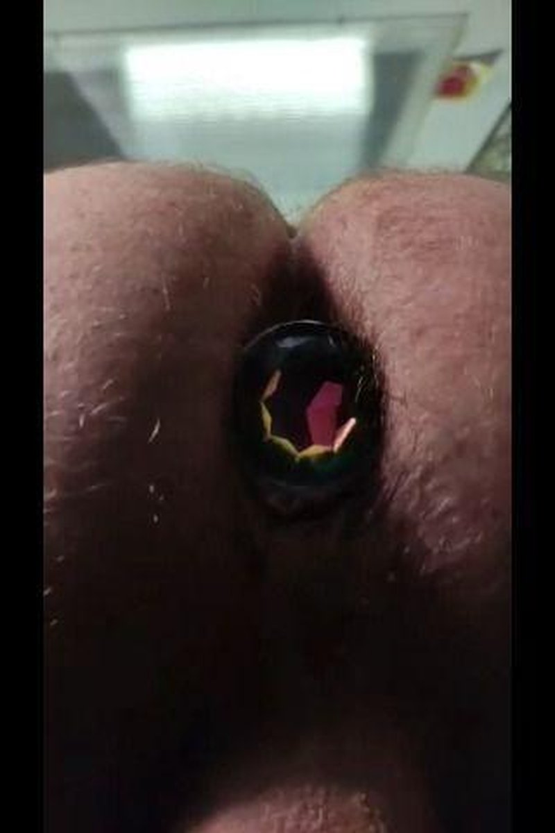 Close Up - Screenshot 1 of 4 - Anal