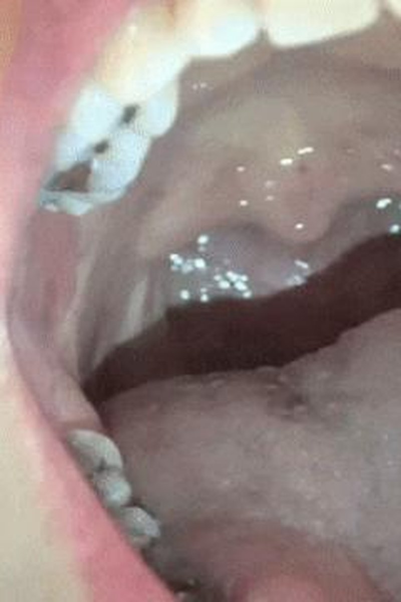 Dancing Uvula - Screenshot 1 of 4 - Brown Hair