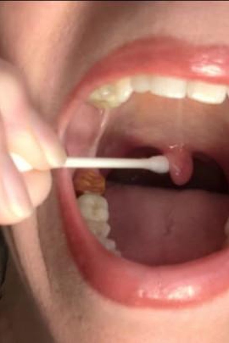 Uvula Play - Screenshot 1 of 4 - Fetish