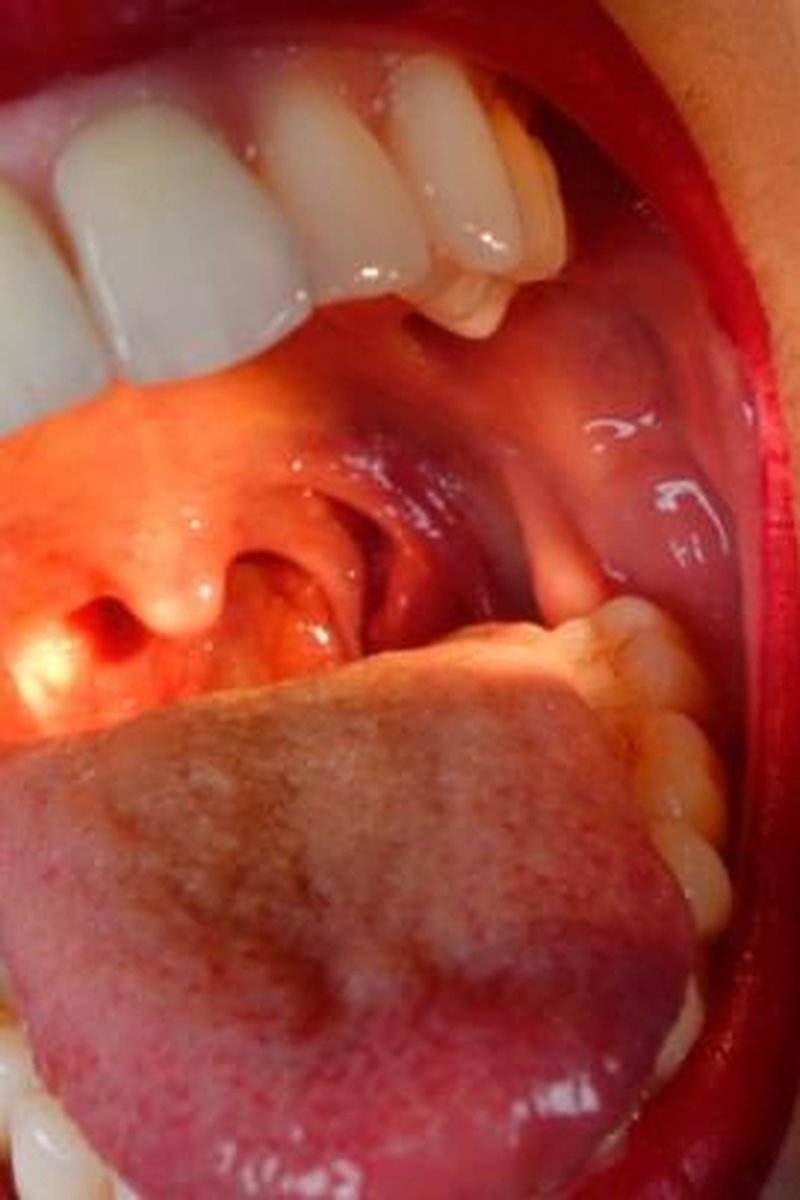 Big Yawns, Uvula And Throat Video Request - Screenshot 1 of 4 - Close Up