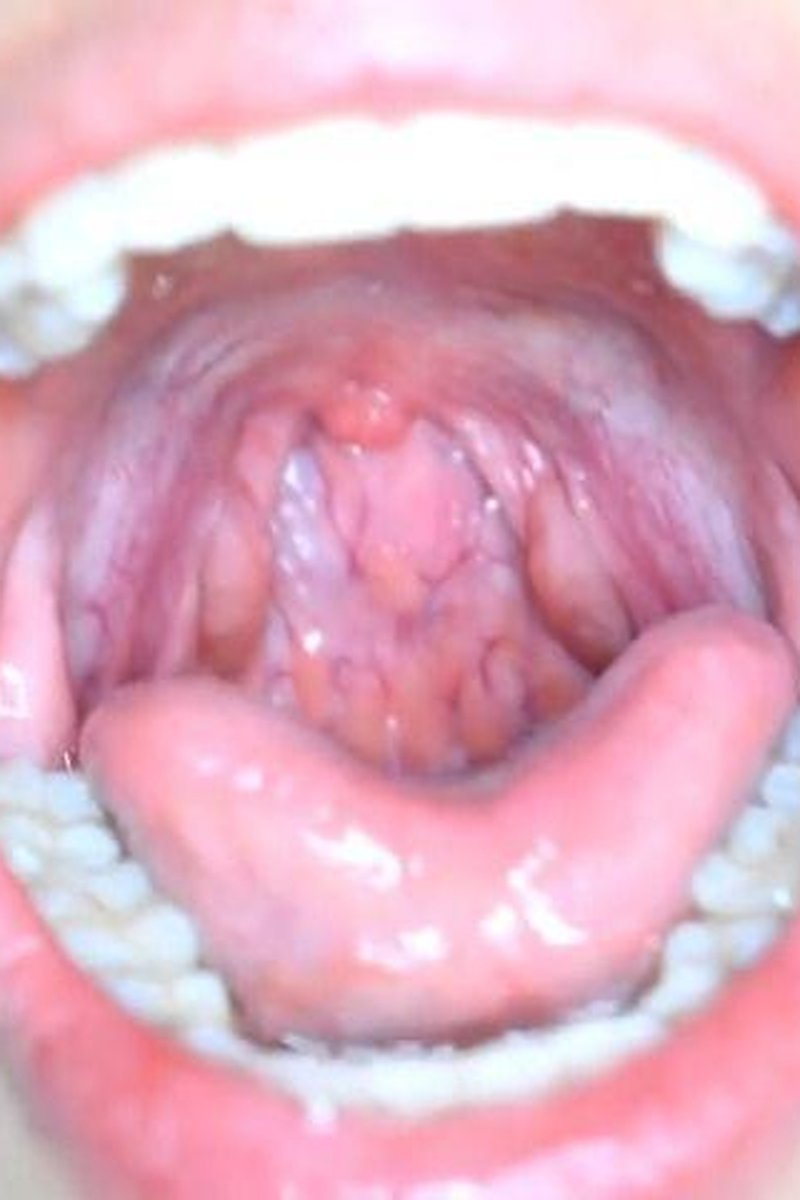 Large Uvula - Screenshot 1 of 4 - Gay
