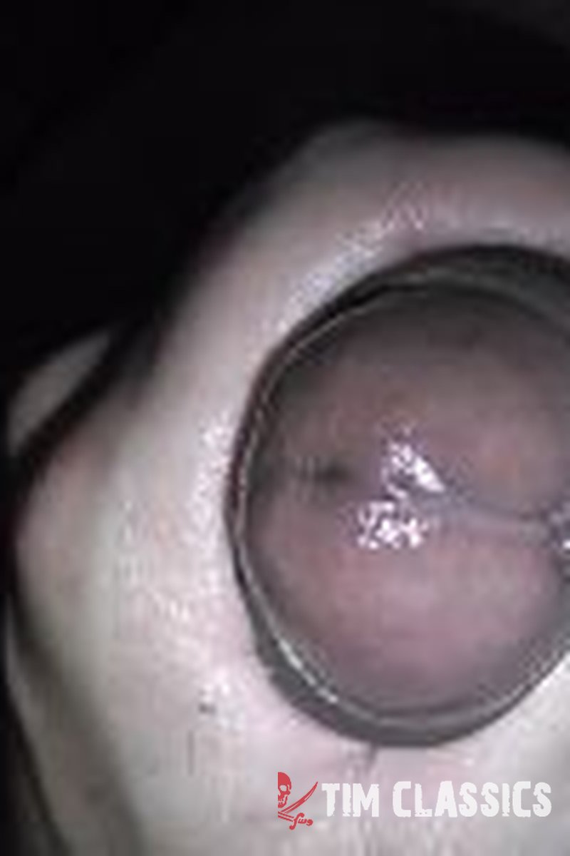 Zach Blunt - Screenshot 1 of 4