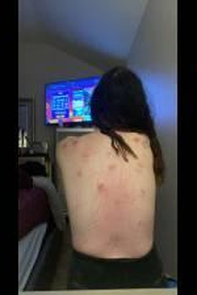 Bruised Ass - Screenshot 1 of 4 - Ass Worship