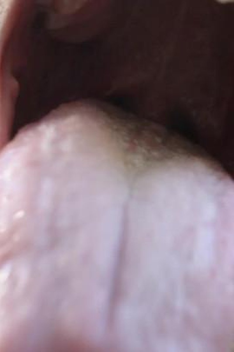Tiny Perv On The Tree - Screenshot 1 of 4 - Giant