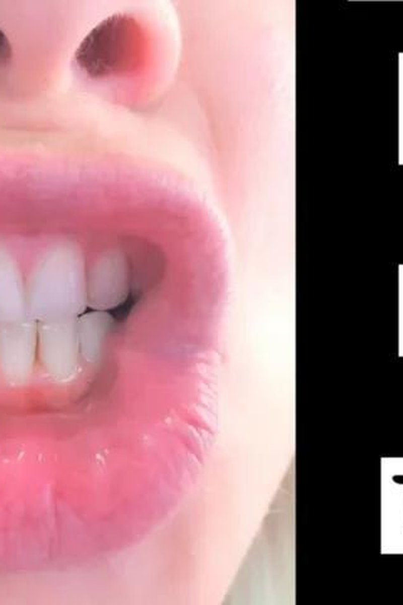 Lips & Teeth Tease - Screenshot 1 of 4 - Pink Candy Ec
