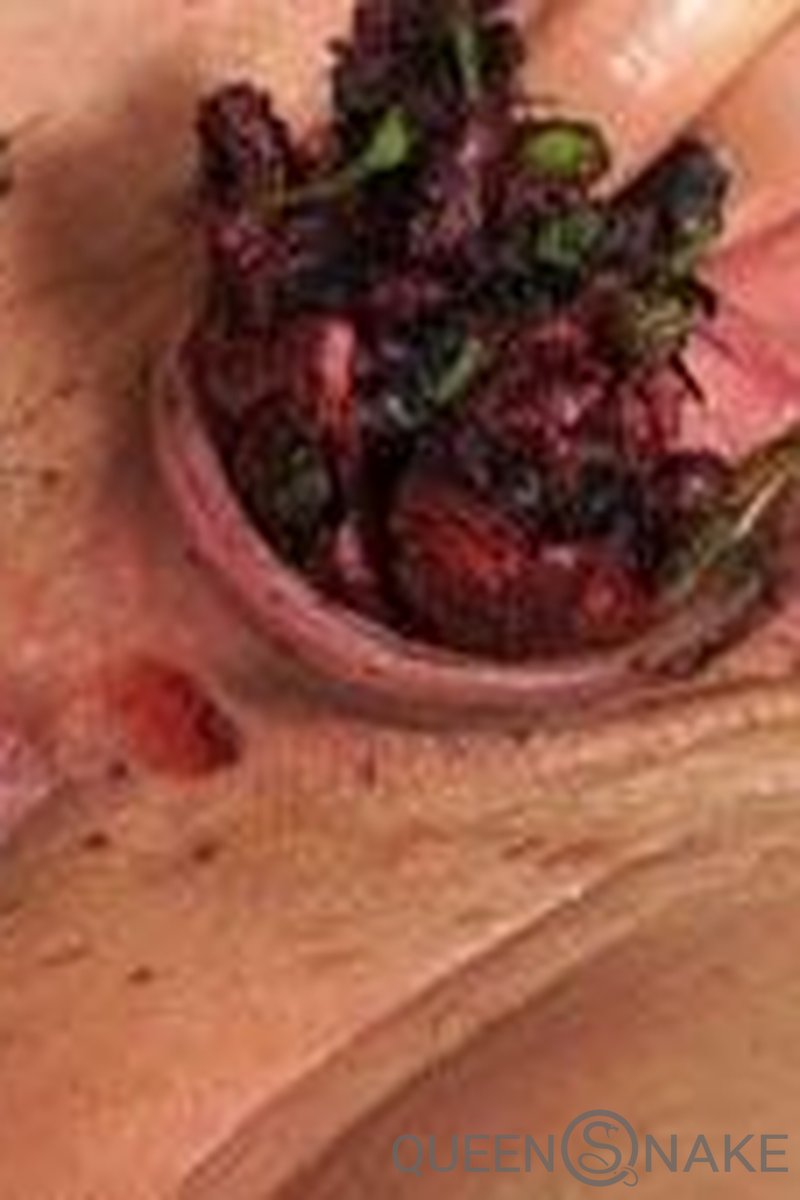 Poppy - Screenshot 1 of 4 - Enema