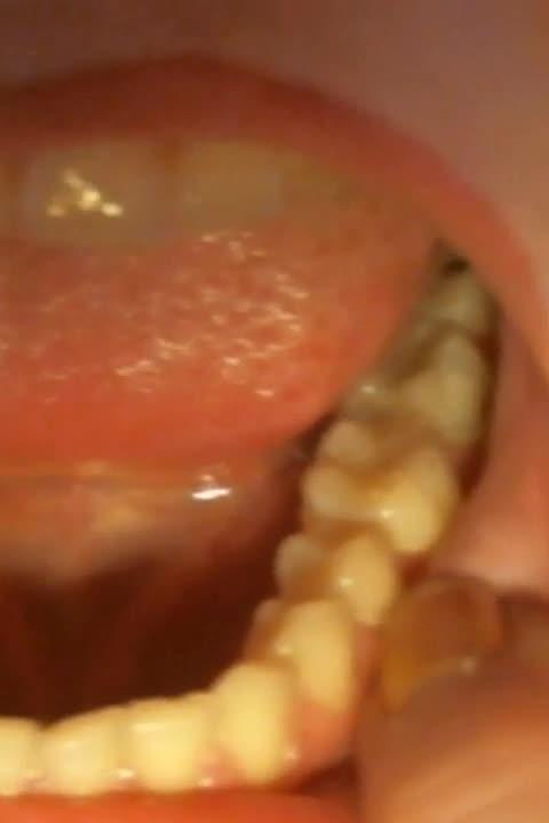 Teeth Fetish - Screenshot 1 of 4 - Fetish