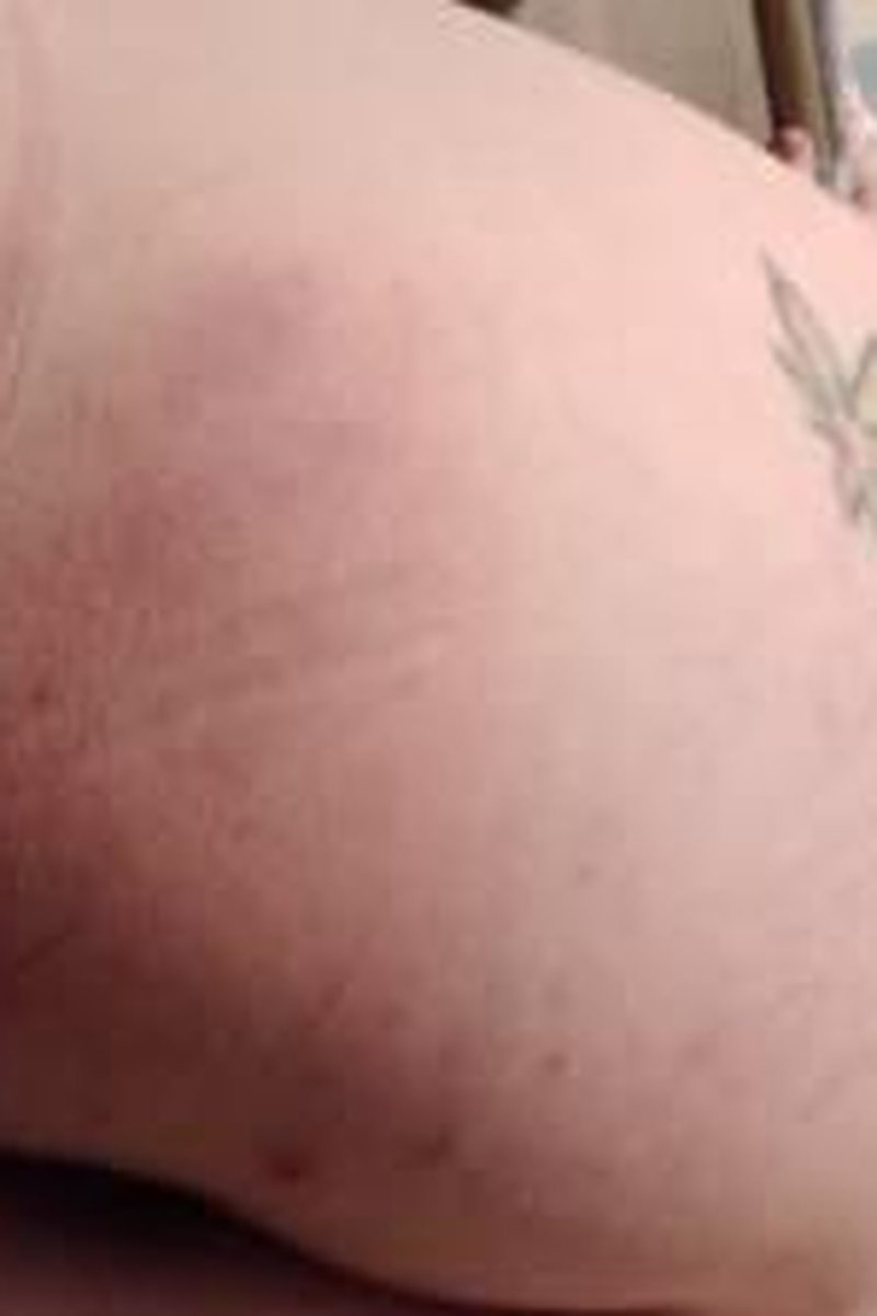 Bruised Ass - Screenshot 1 of 4 - 20-23 Years Old