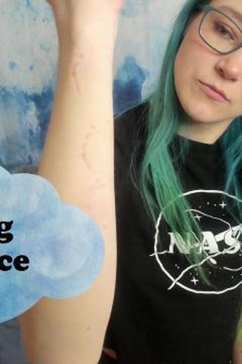 Biting Practice - Screenshot 1 of 4 - Bite Marks