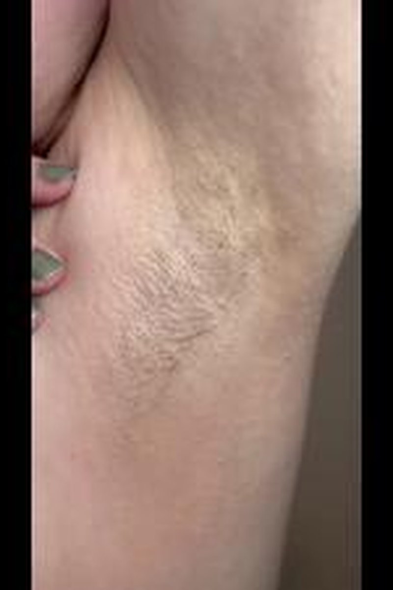 Worship These Hairy Lady Pits - Screenshot 1 of 4 - Armpit Fetish