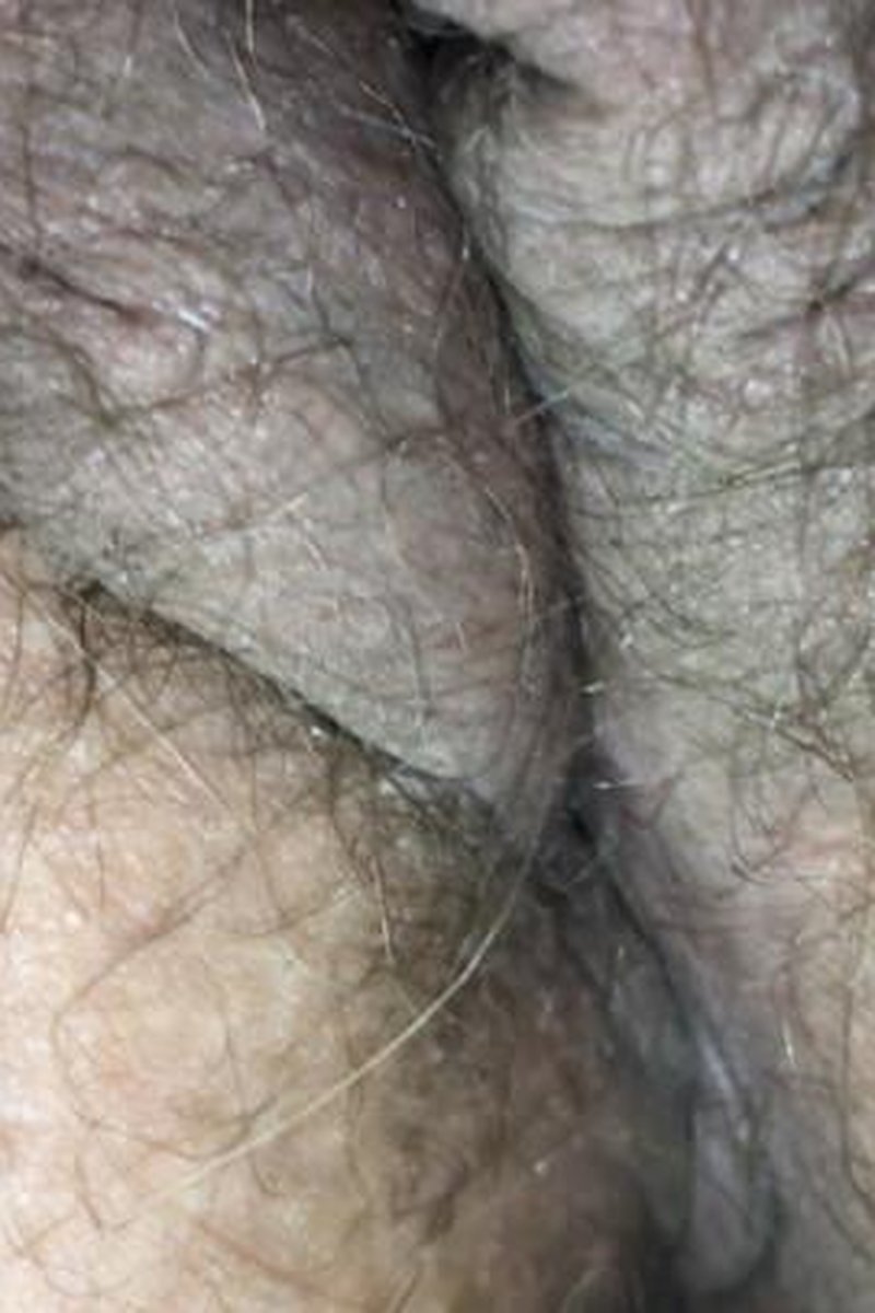 BBW Up Close Pussy And Asshole - Screenshot 1 of 4 - BBW