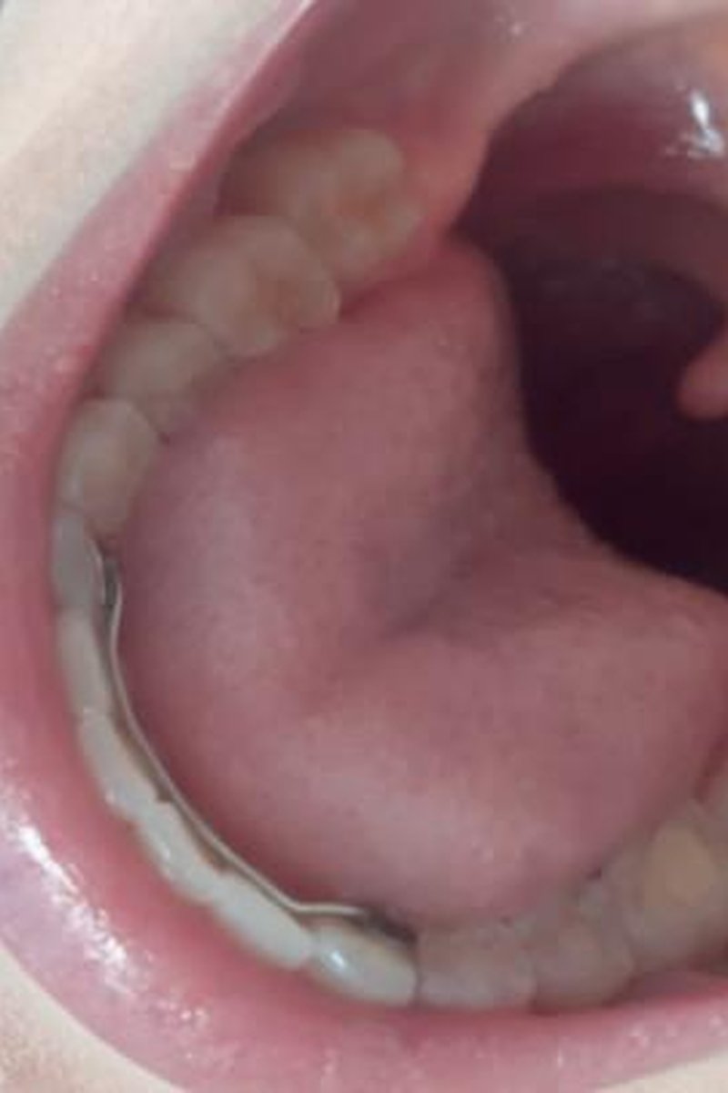 Swallowed By Your Date - Screenshot 1 of 4 - Amateur
