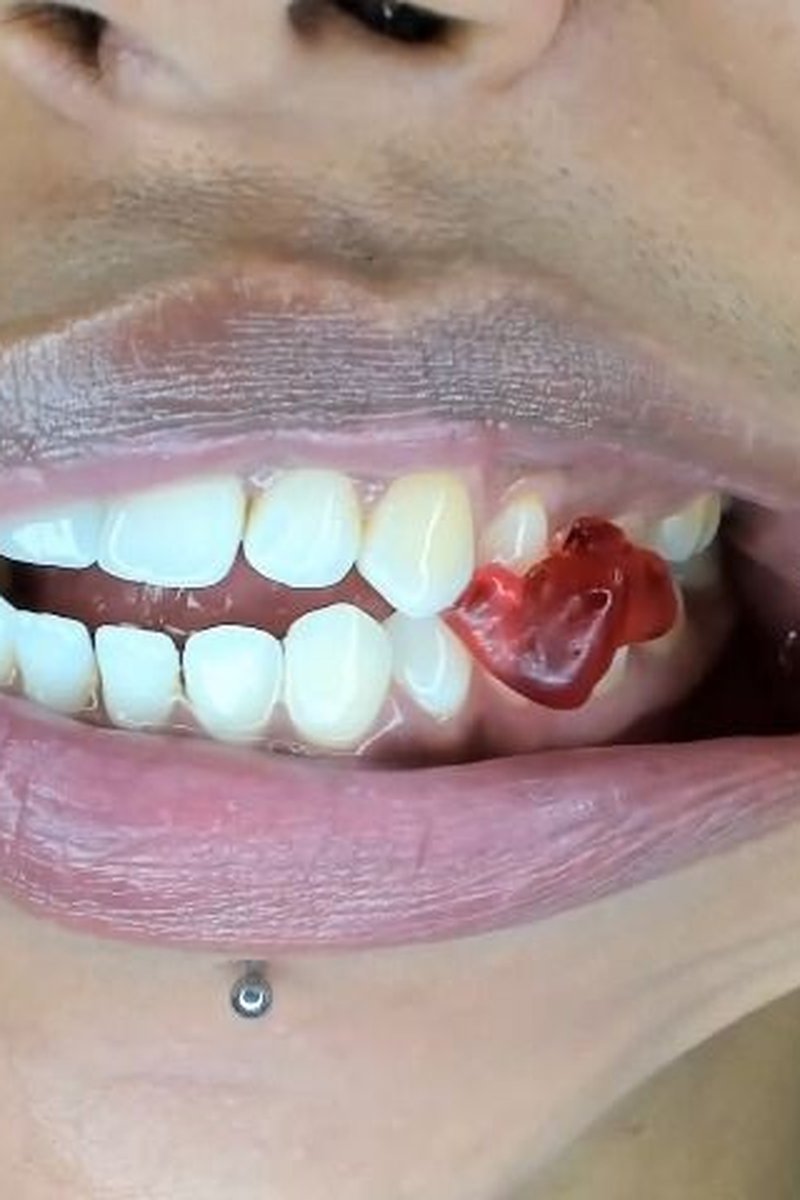 My Sharp Lethal Teeth - Screenshot 1 of 4 - Fetish