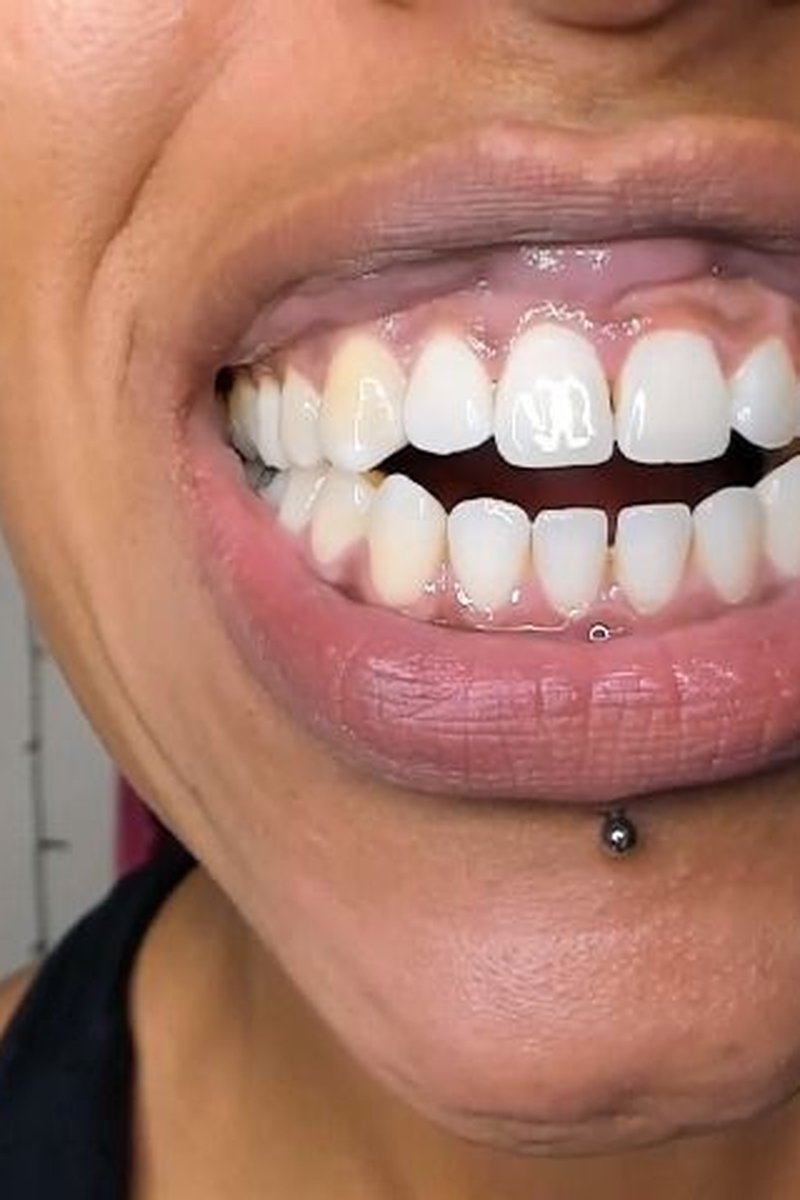 My Sharp Teeth Vore Description - Screenshot 1 of 4 - Mouth Fetish