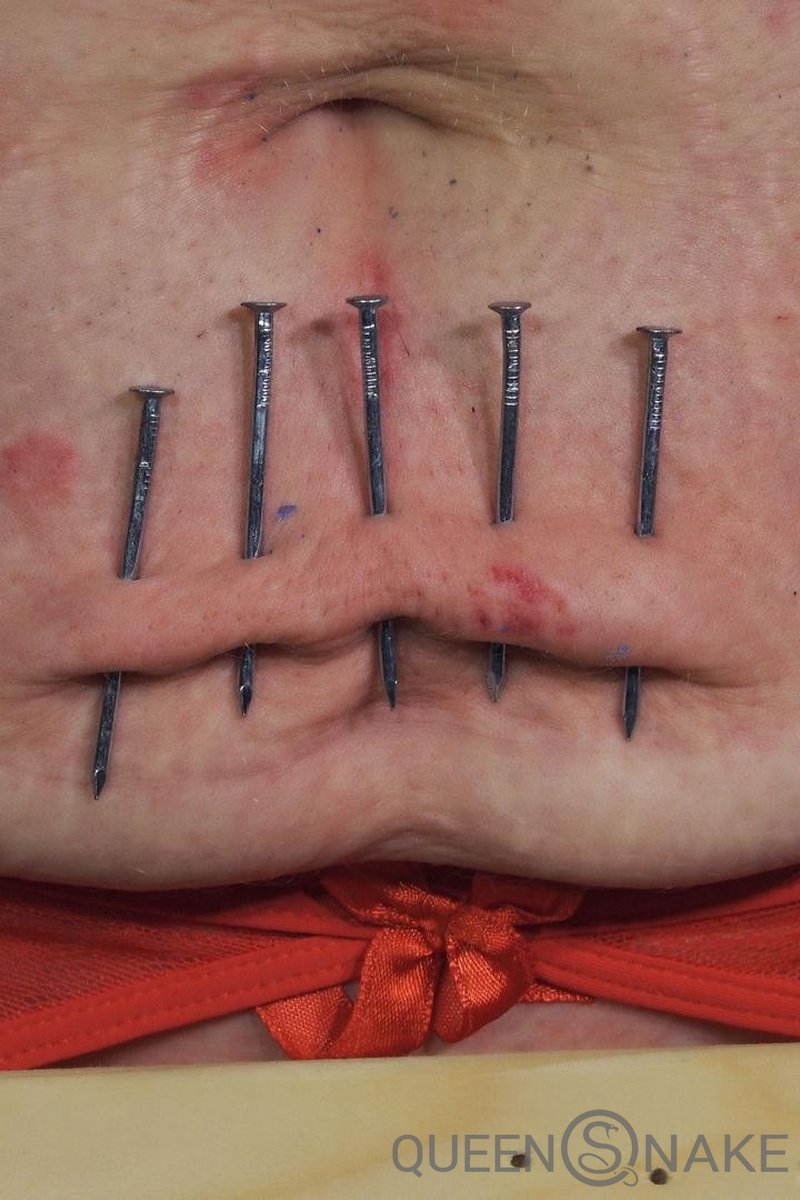 Flabby Abby - Screenshot 1 of 4 - Barbed Wire