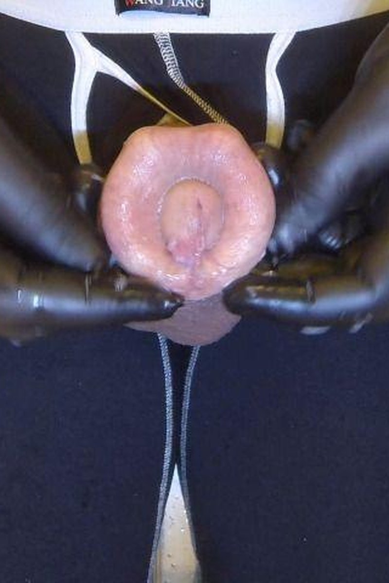 Returned Foreskin - Screenshot 1 of 4 - Fetish