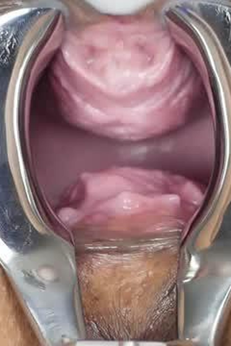 Speculum - Have A Deep Look Inside My Pussy - Screenshot 1 of 4 - Asian