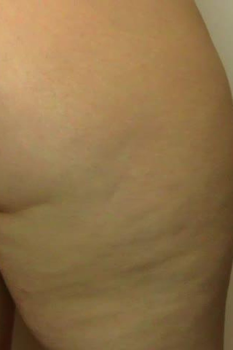 Tiny Man In Trap - Screenshot 1 of 4 - Ass Worship