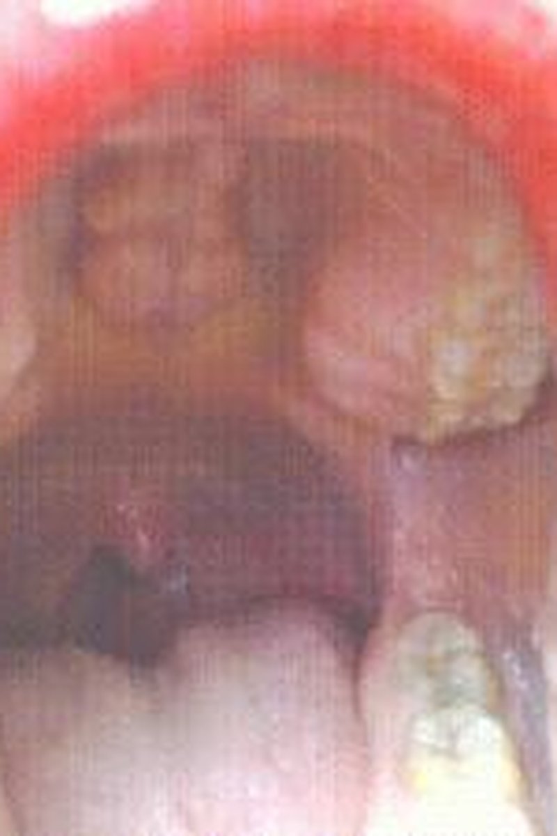 Moving Uvula - Screenshot 1 of 4 - Black