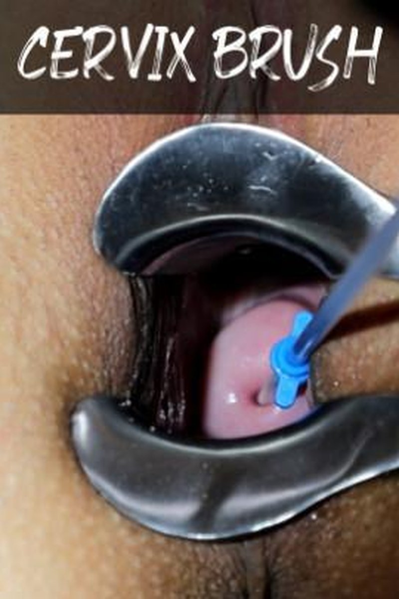 Cervix Brush - 3 POV - Gyno Fetish - Screenshot 1 of 4 - Medical Fetish