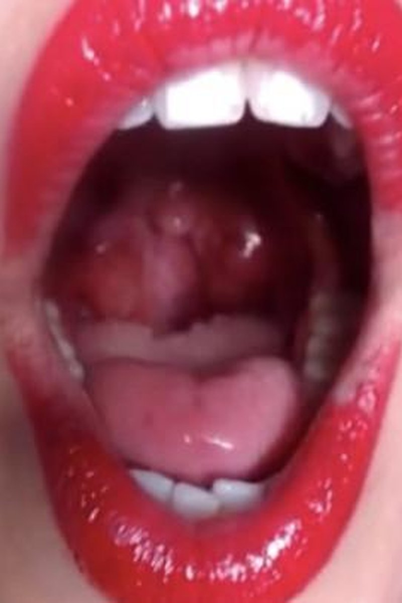 Uvula Moan - Screenshot 1 of 4 - Close Up
