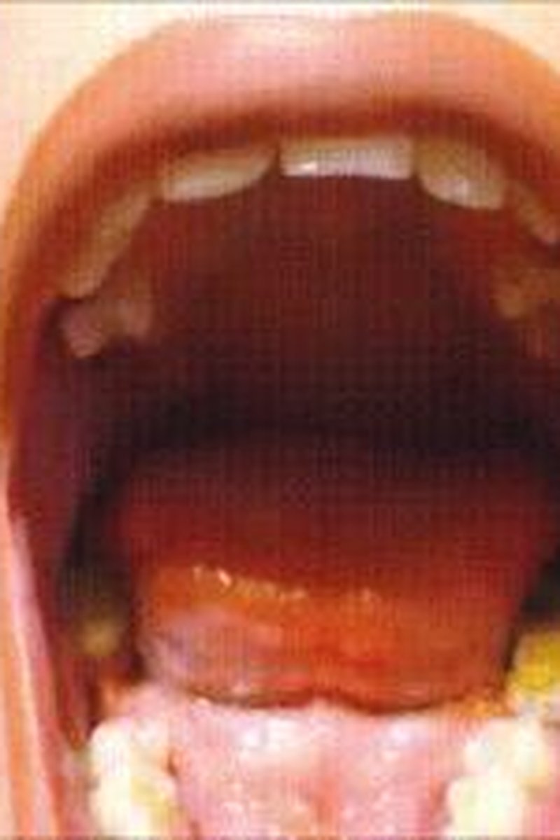 **** Compilation - Screenshot 1 of 4 - Fetish