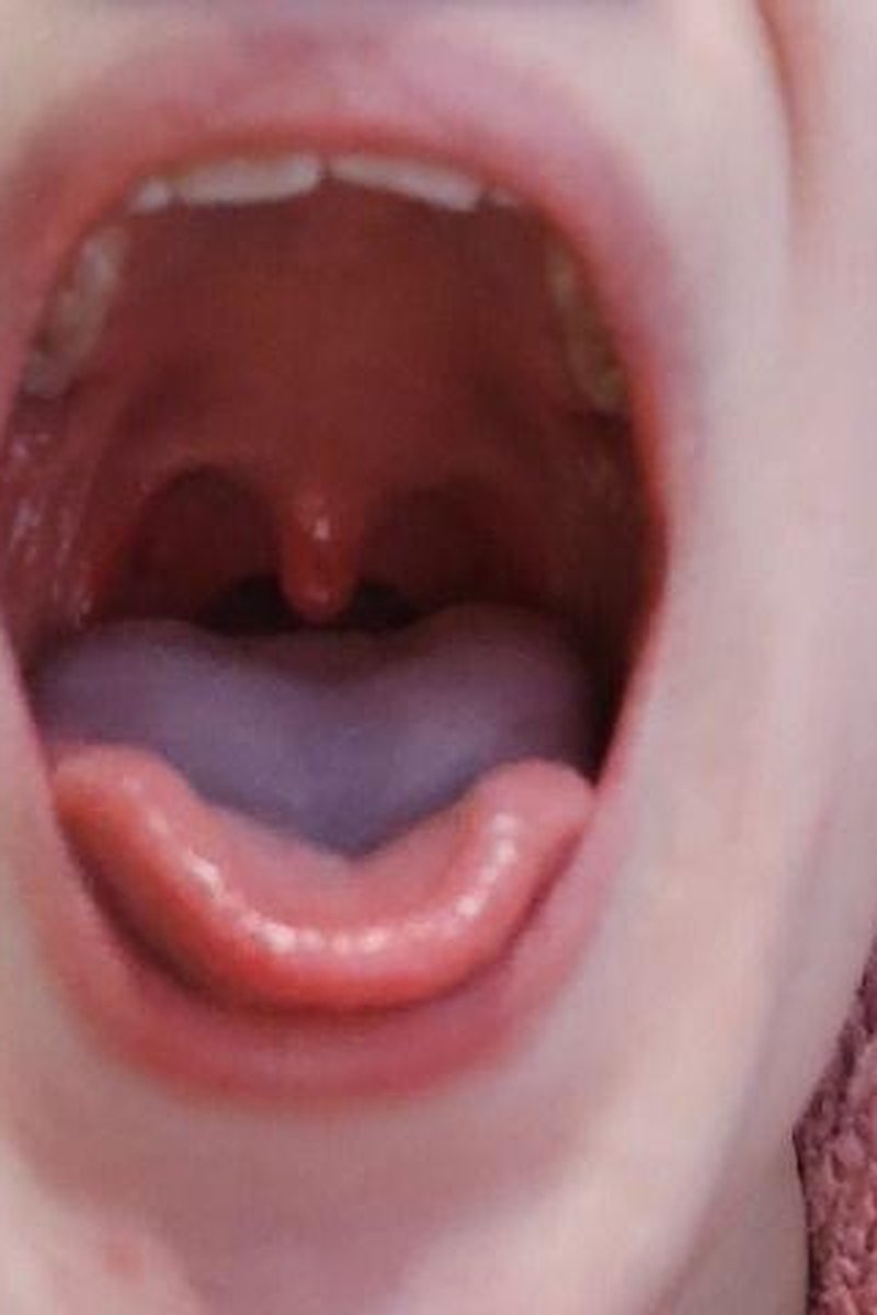 Mouth Close Up - Screenshot 1 of 4 - Close Up