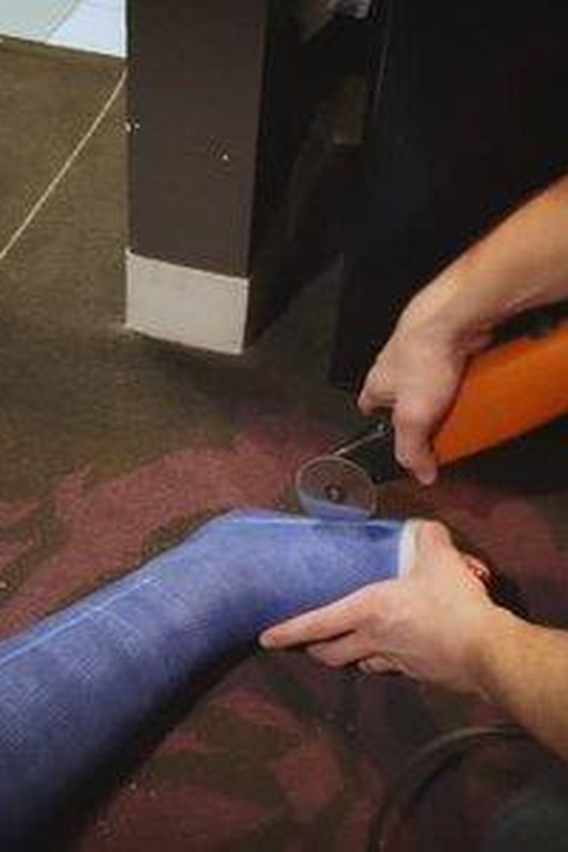 Cast Removal - Screenshot 1 of 4 - Behind The Scenes