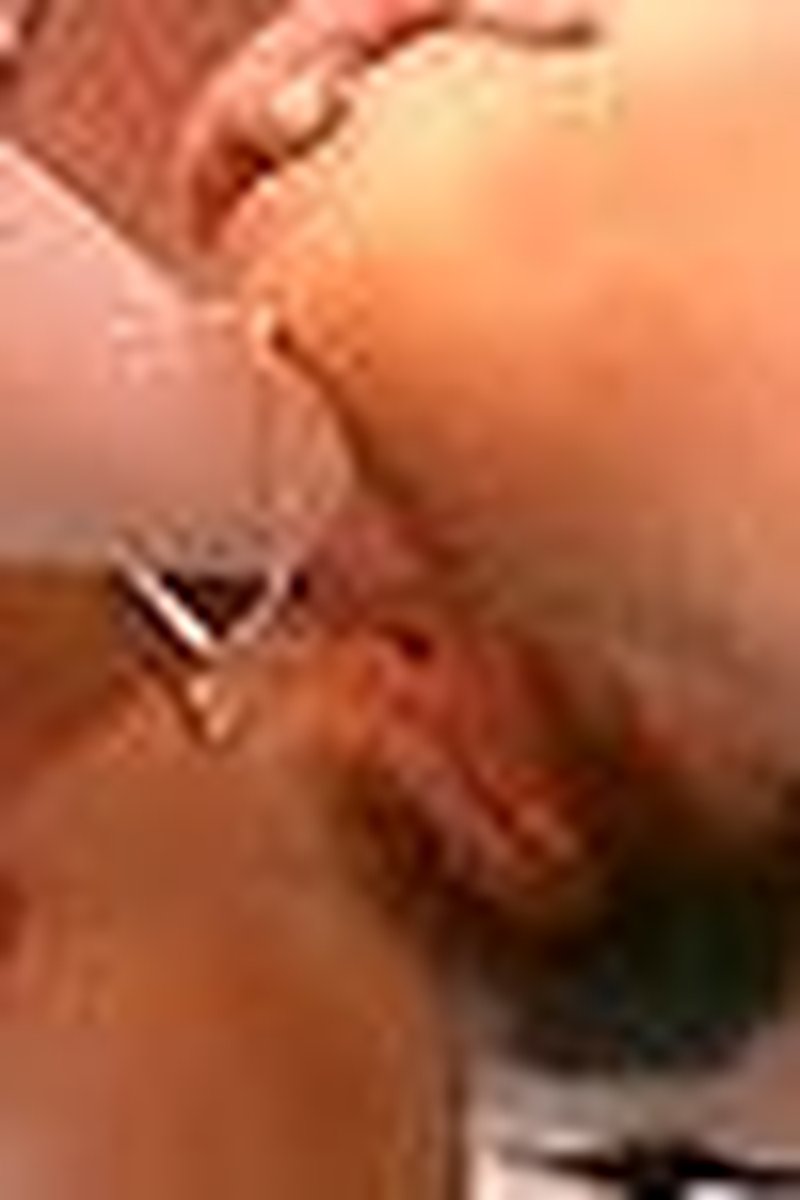 Lesbian Anal Fisting - Screenshot 1 of 4 - Anal