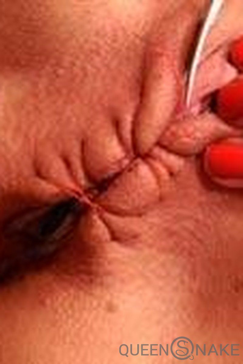 Workout - Screenshot 1 of 4 - Flashing