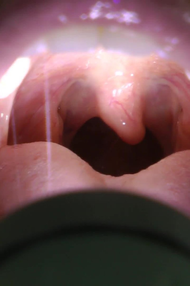 Uvula Fetish - Screenshot 1 of 4 - Close Up