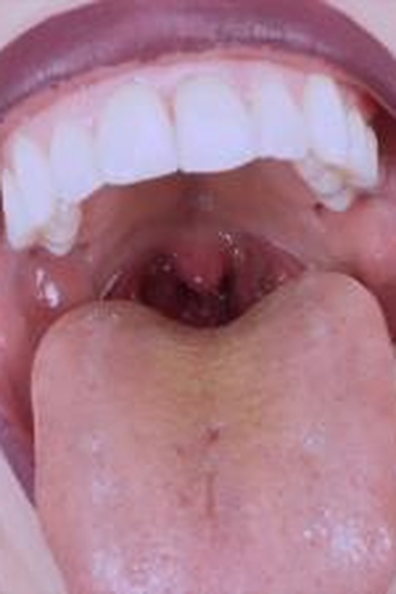 Cum On My Uvula Uvula And Burps - Screenshot 1 of 4 - Close Up