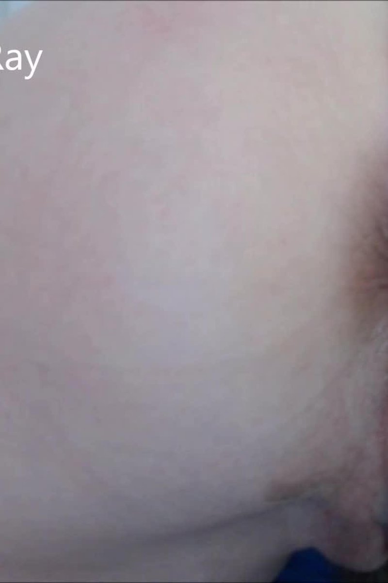 Farting Closeup - Screenshot 1 of 4 - Anal
