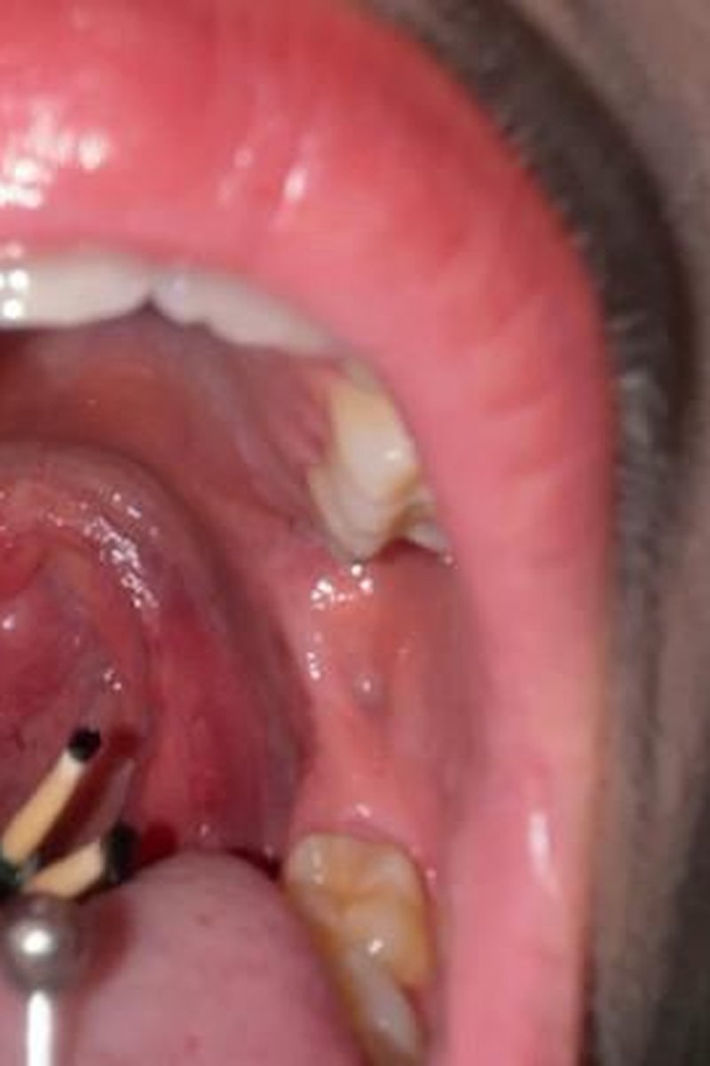 Missing Student - Screenshot 1 of 4 - Fetish