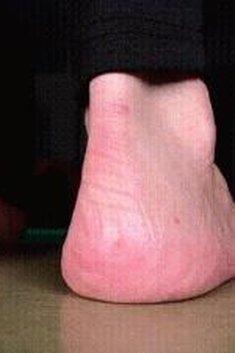Ms Coco Heel Squeeze! - Screenshot 1 of 4 - Barefoot