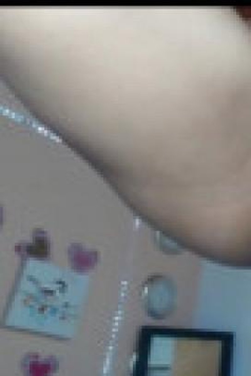 Prolapse - Screenshot 1 of 4 - Golden Shower