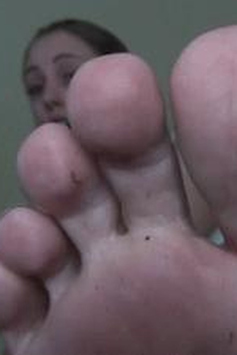 My Toe Scar - Screenshot 1 of 4 - Body Worship