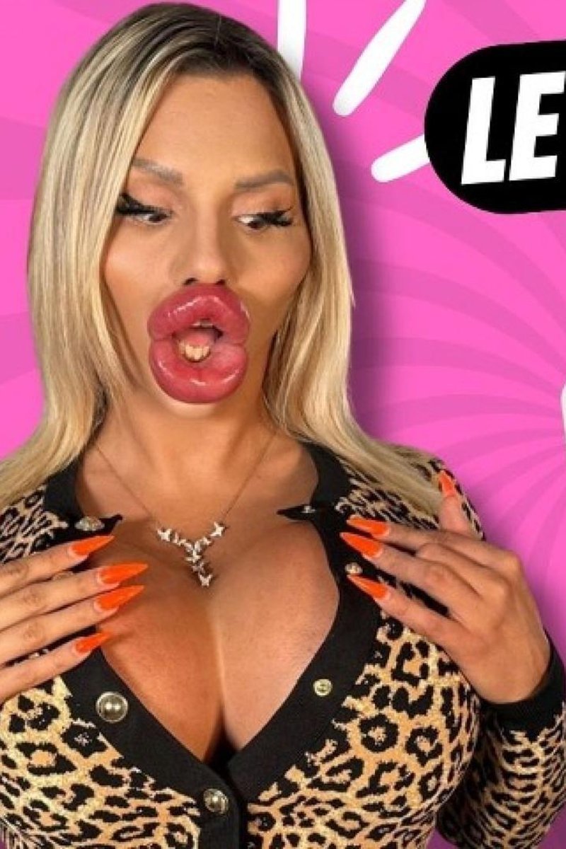 Most Plastic Surgery - Screenshot 1 of 4 - Biglips