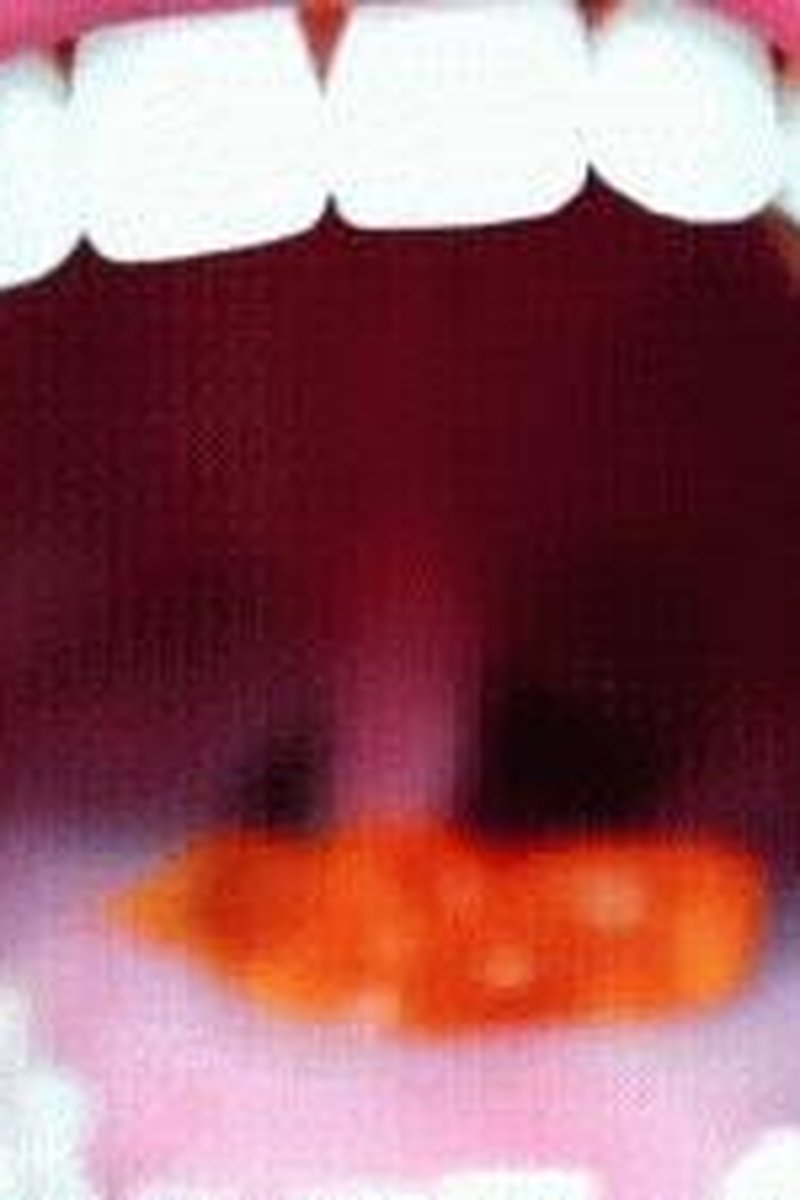 Gummy **** - Screenshot 1 of 4 - Fantasy