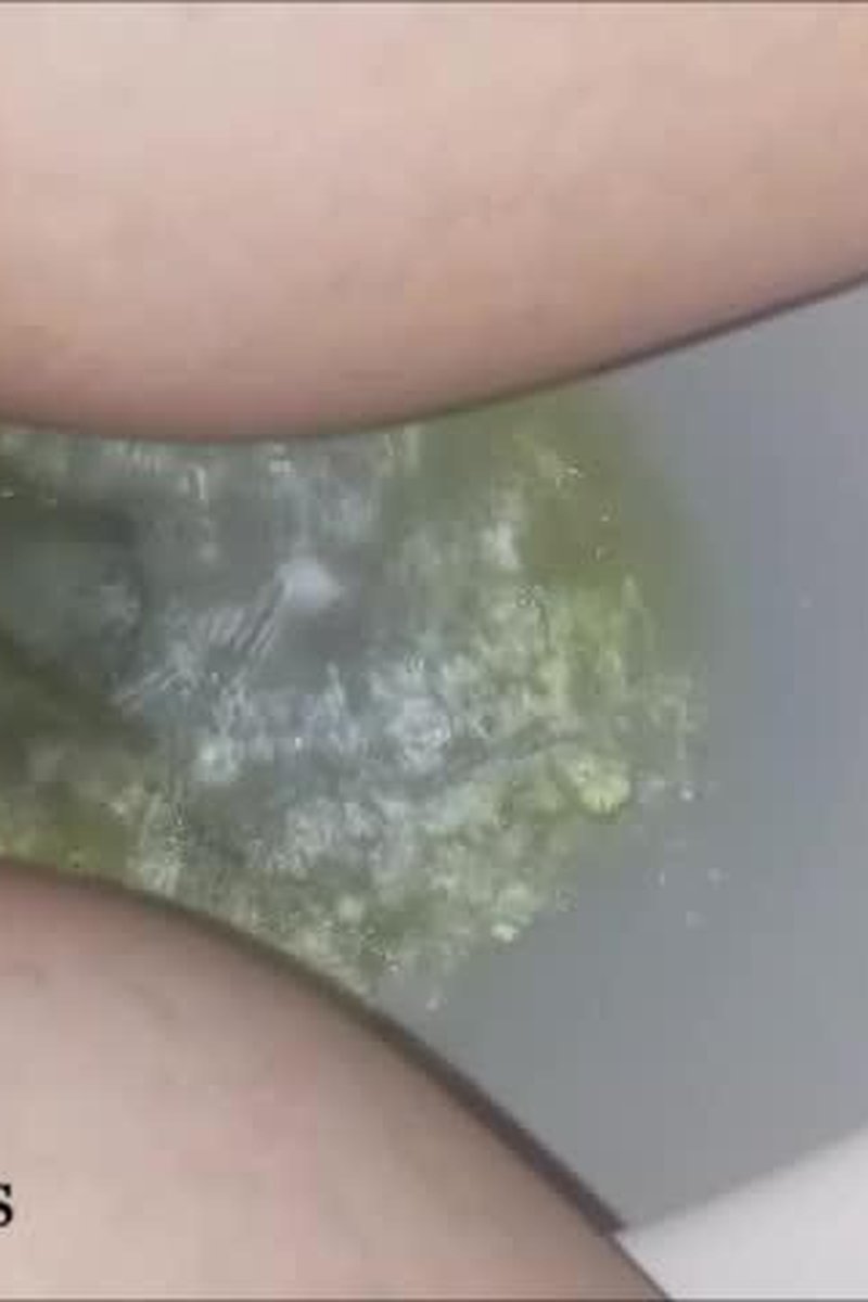 FEB2017 Pee Diary - Screenshot 1 of 4 - Confessions