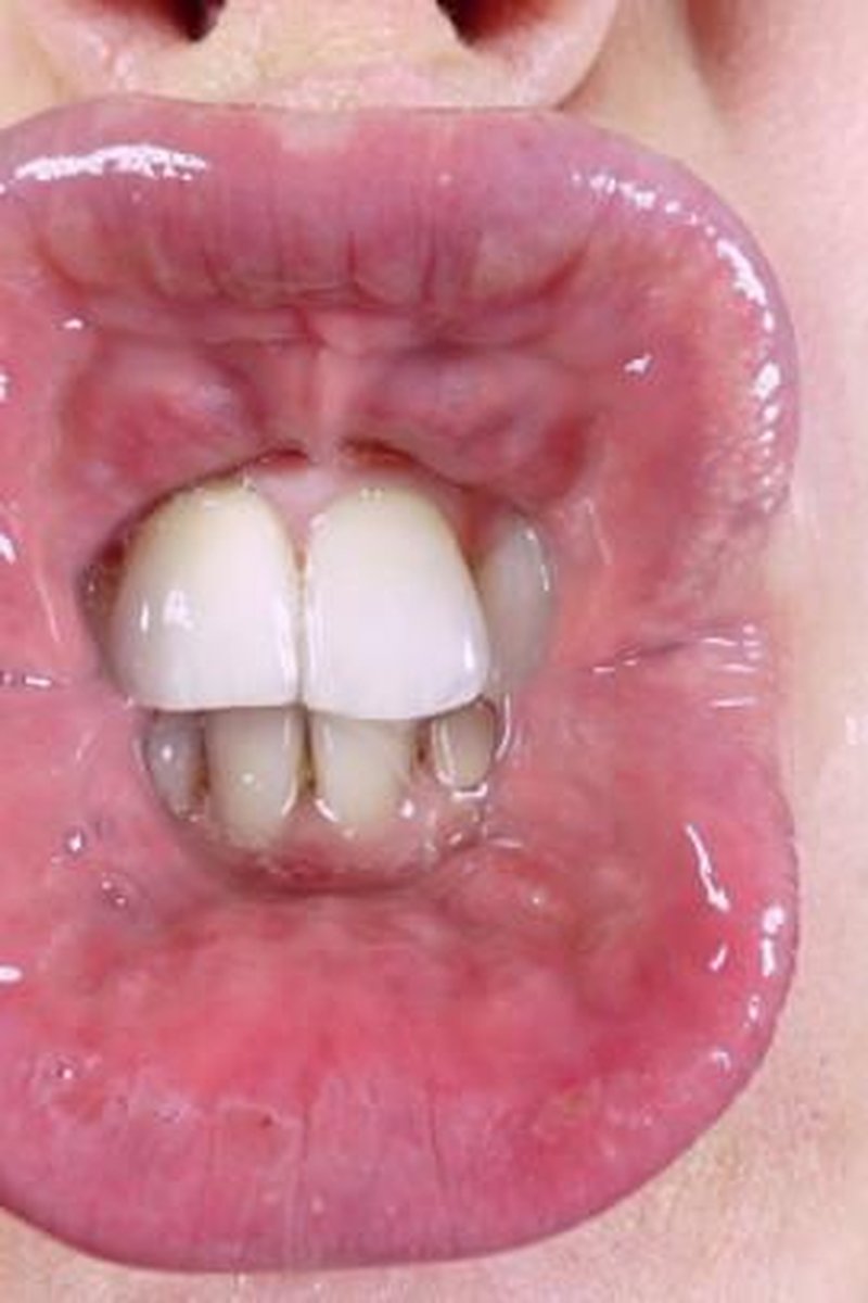 Spitty Square Lips - Screenshot 1 of 4 - Close Up