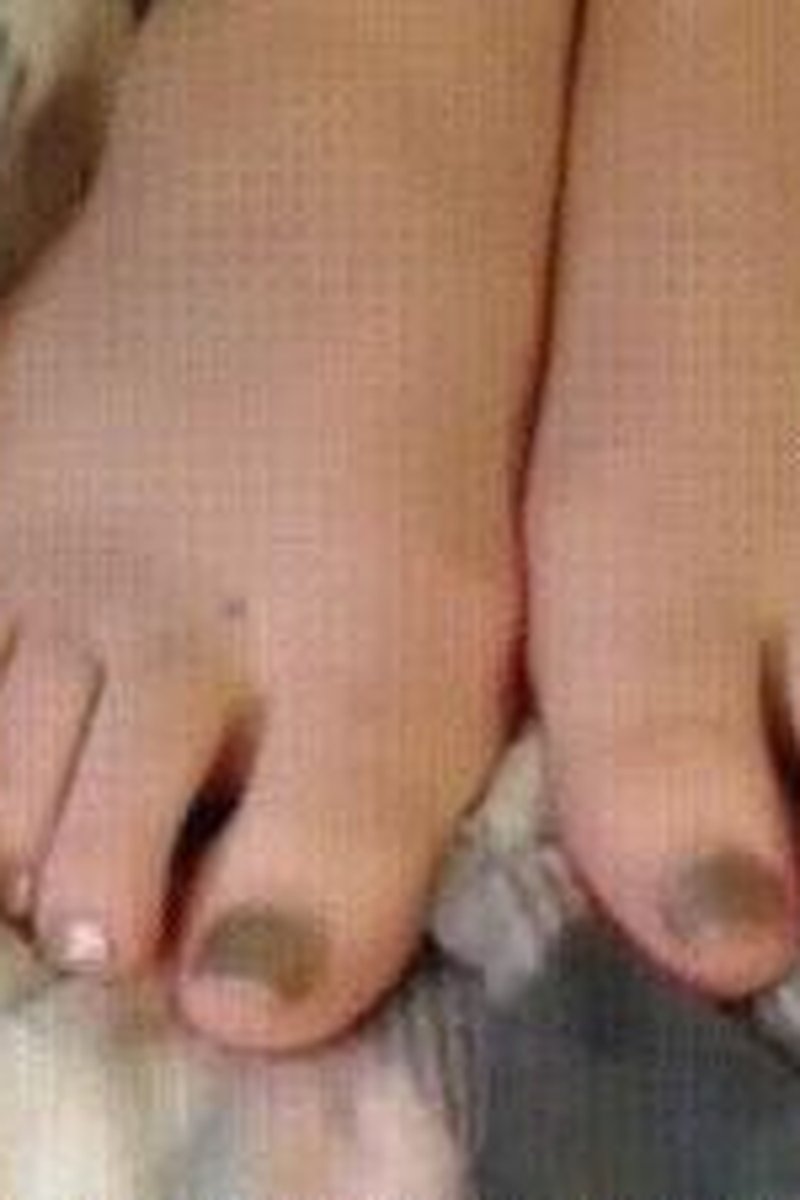 Toe Wiggling - Screenshot 1 of 4 - Foot Fetish