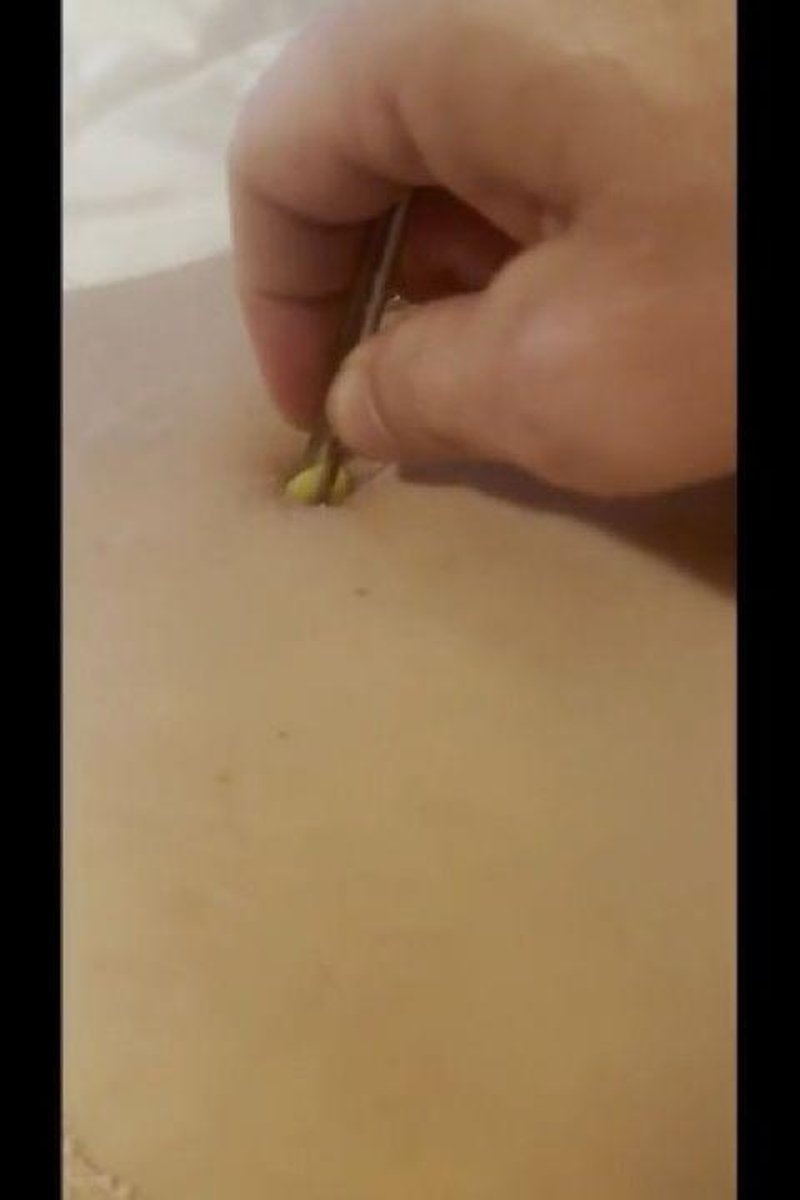 Worm Inserted Into My Button - Screenshot 1 of 4 - Belly Fetish