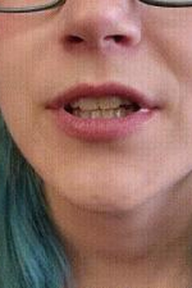Teeth Tour - Screenshot 1 of 4 - Face Fetish