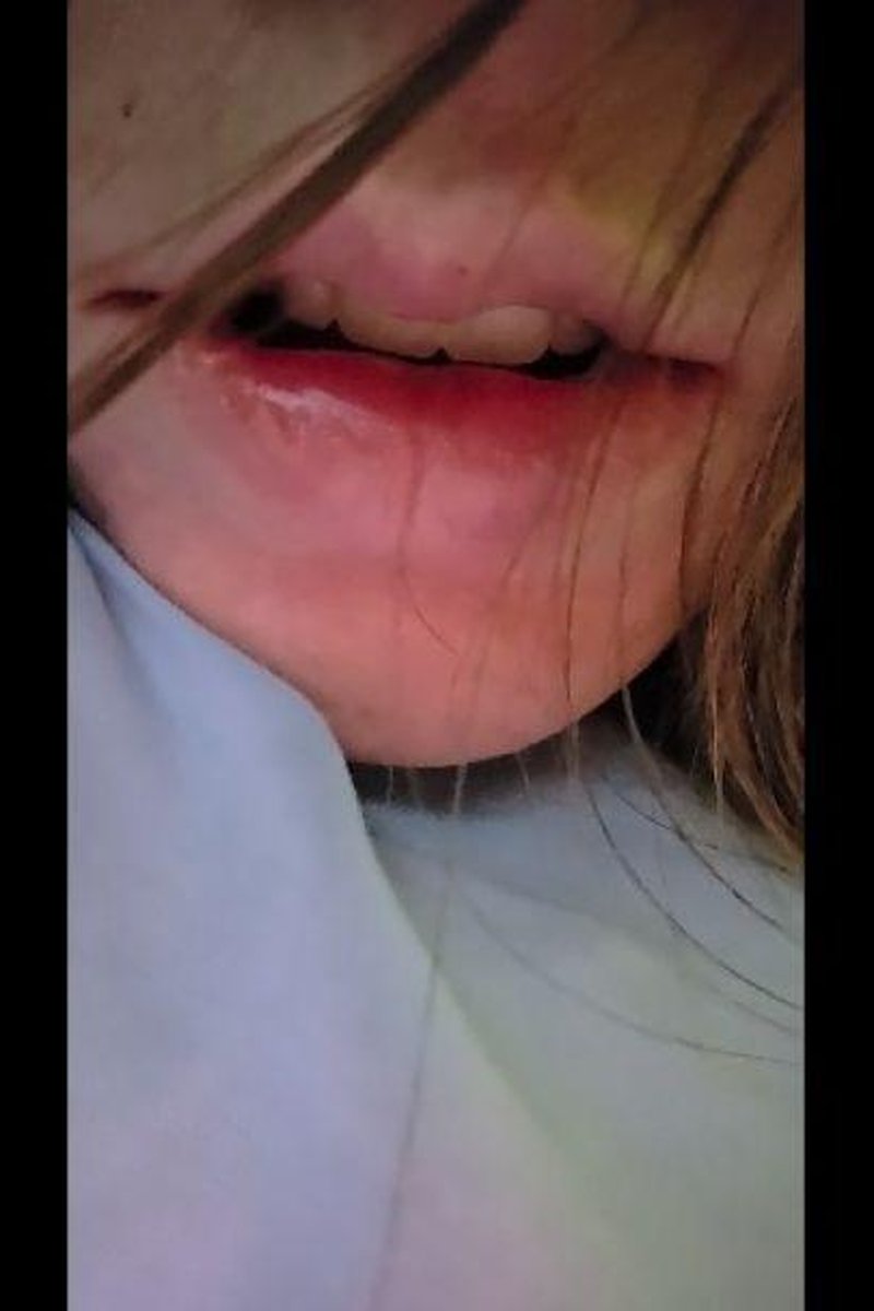 Mouth Up Close - Screenshot 1 of 4 - Lippuckering