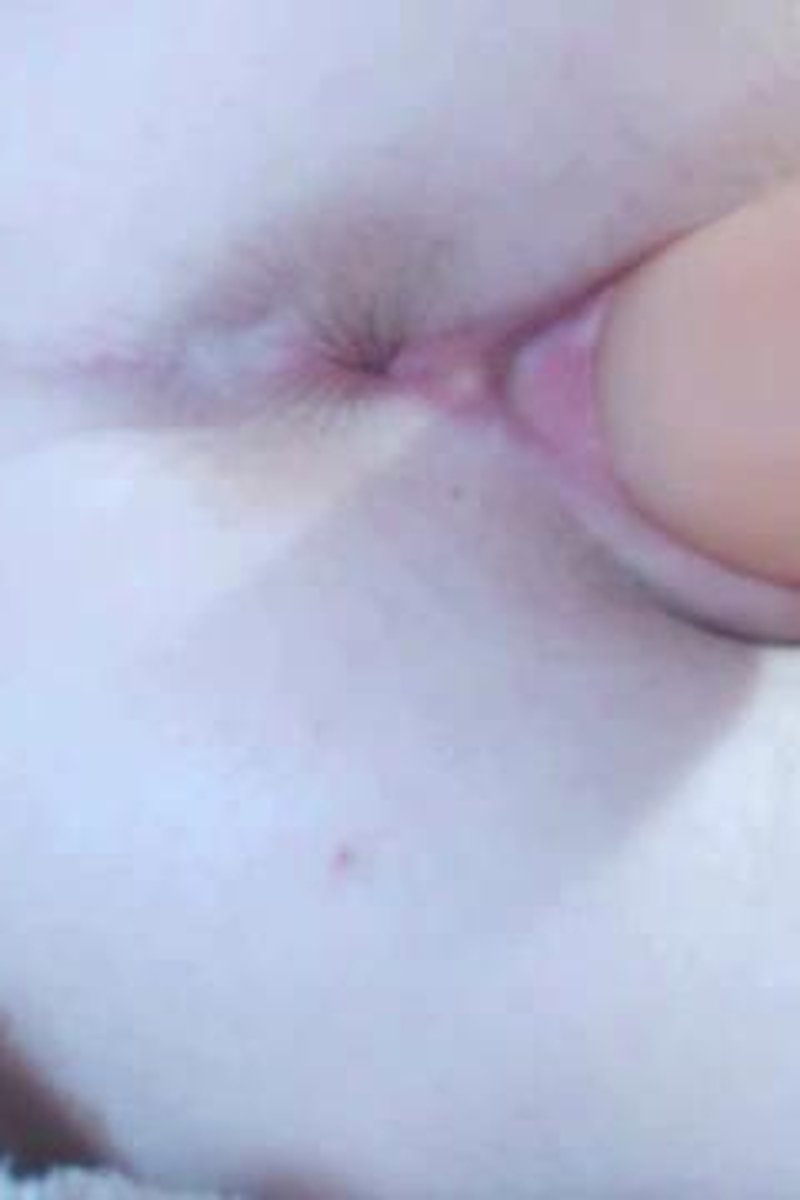 Fat Dildo Stuffing - Screenshot 1 of 4 - Anonymous Porn