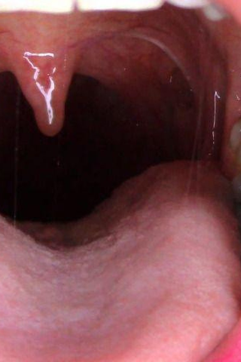 Uvula Flexing & Vibrating - Screenshot 1 of 4 - Fetish