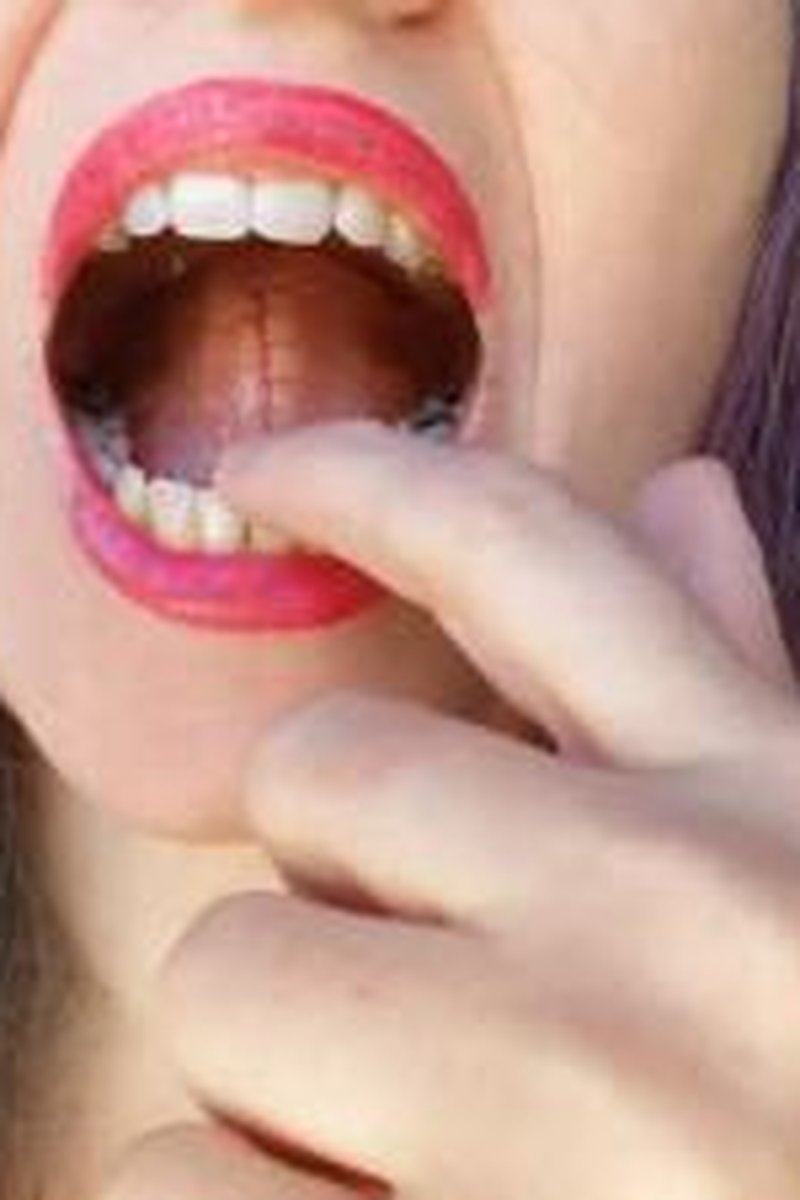After Dentist - Screenshot 1 of 4 - Gum