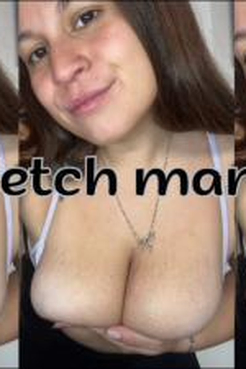 Stretch Marks - Screenshot 1 of 4 - Belly Fetish