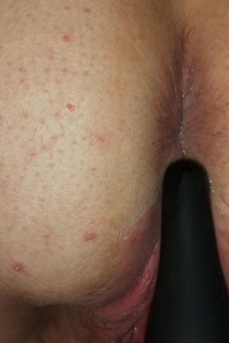 Buttplug - Screenshot 1 of 4 - Anal